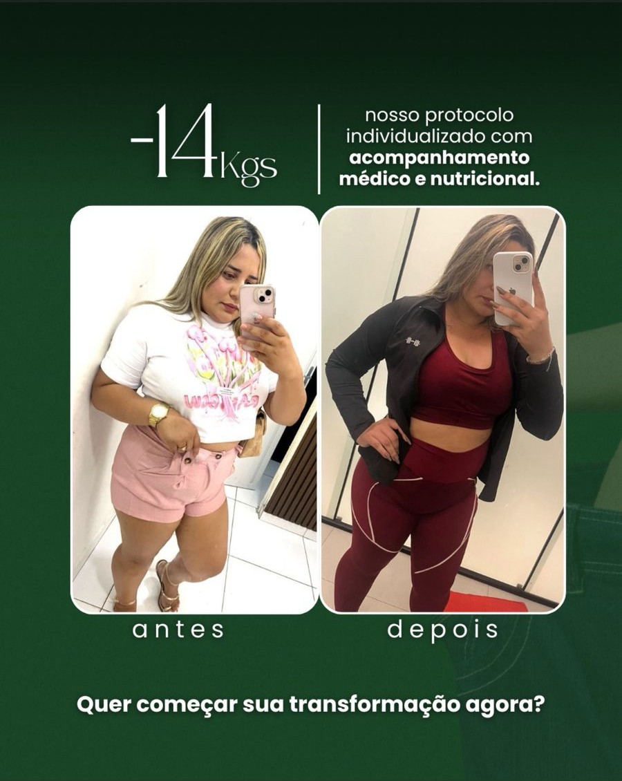 Resultado Antes e Depois 1