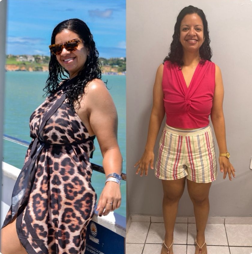 Resultado Antes e Depois 3